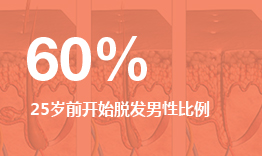 干細胞治療脫發,25歲前開始脫發男性比例占60%